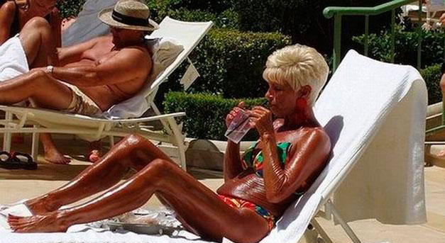 La tanorexia, cuando estar moreno se convierte en obsesión